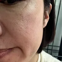 关于20万人问的缩毛孔！一定要看！（纯分享）