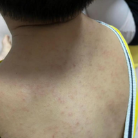 儿童洗护选温和型还是修护型？1000+用户观点大碰撞