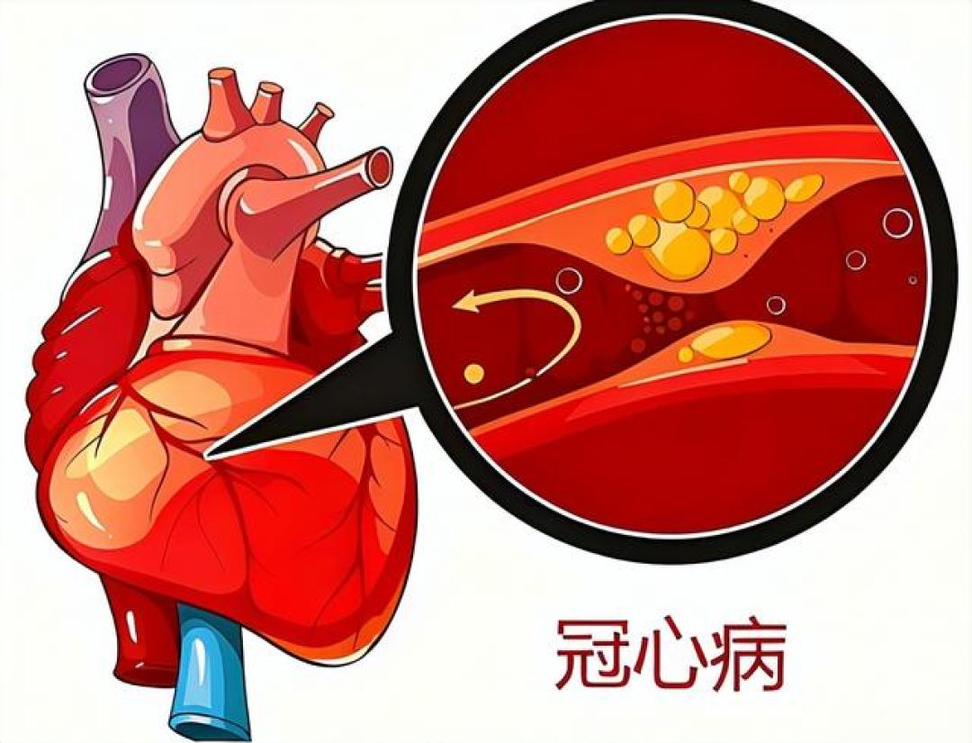 苹果再次被重视!研究发现:冠心病患者常吃苹果,或出现5种改善