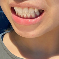 牙龈萎缩、牙齿酸软？2026对症测评5款牙膏：这款全效修护封神