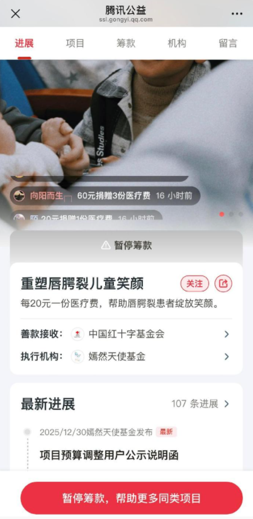 大量网友捐款!嫣然天使基金回应:常规筹款预算已筹满