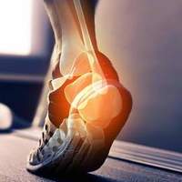 超过60%跳绳者遇到的难题：足底疼怎么办？4个动作有效缓解