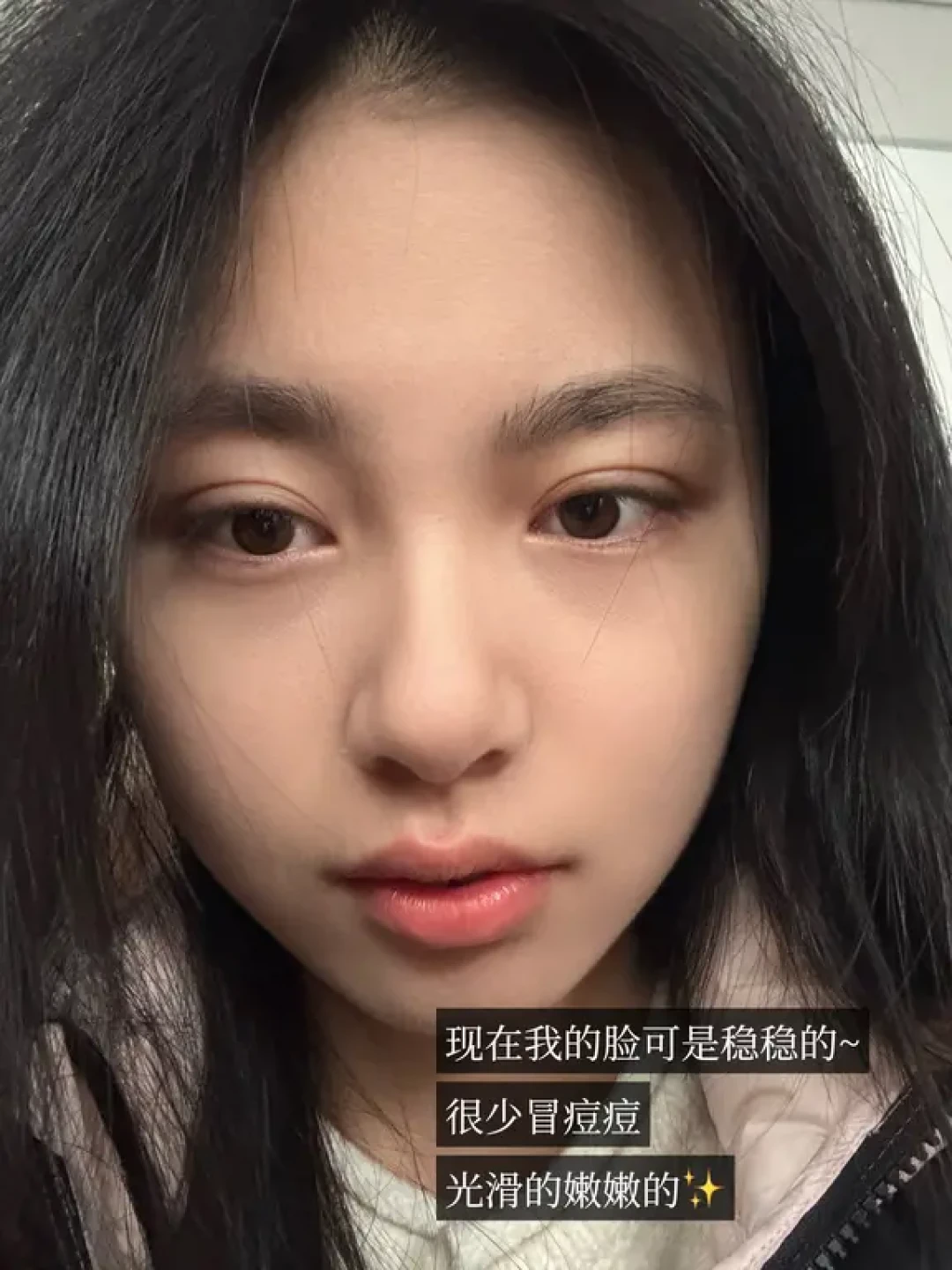 06女大plog |本人60天战痘成功手记