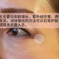 告别泛红刺痛，这6款抗衰老高端面霜是敏感肌的心头好