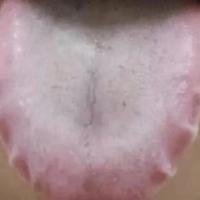 告别冠心病困扰！名老中医揭秘 3 大对症方案，中医温阳通脉超管用
