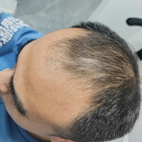 头屑多到像下雪？3款去屑神器实测，洗一次就见效!