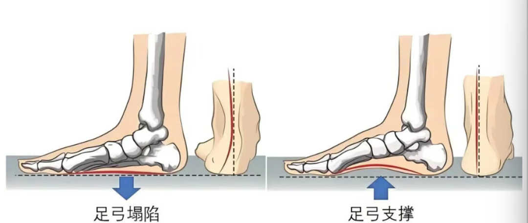 腿型好不好,关键看“足弓”!普拉提这样练,养出笔直长腿