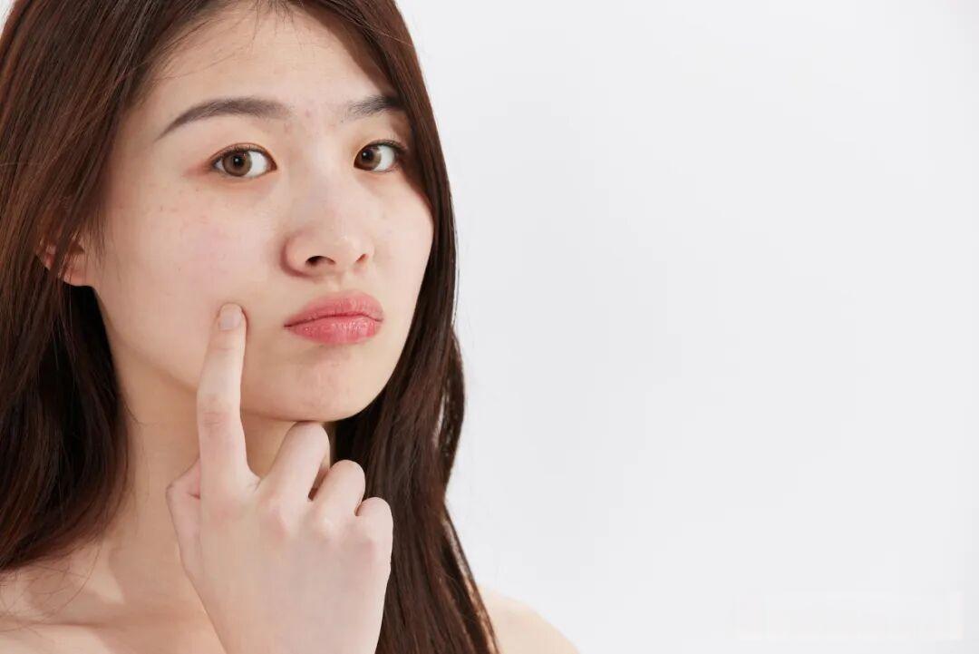 【道医养生】脸上长斑,体内多有瘀!按这四个穴位,气色好得不得了!