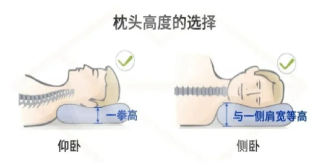 早上起来脖子又僵又疼？怎么办才能科学缓解？