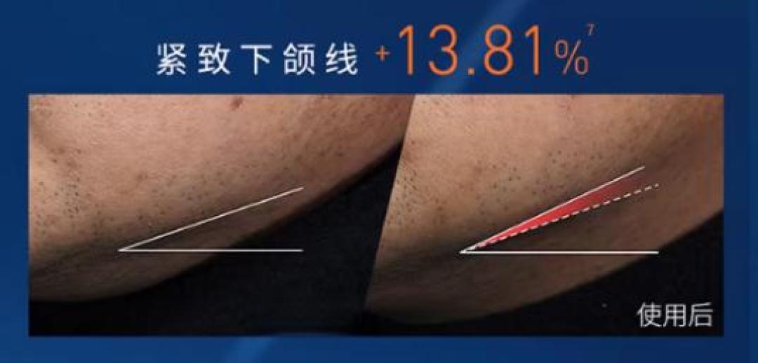 NO.415面霜测评:欧莱雅男士青春肌源淡纹霜,紧致下颌线太扯了!