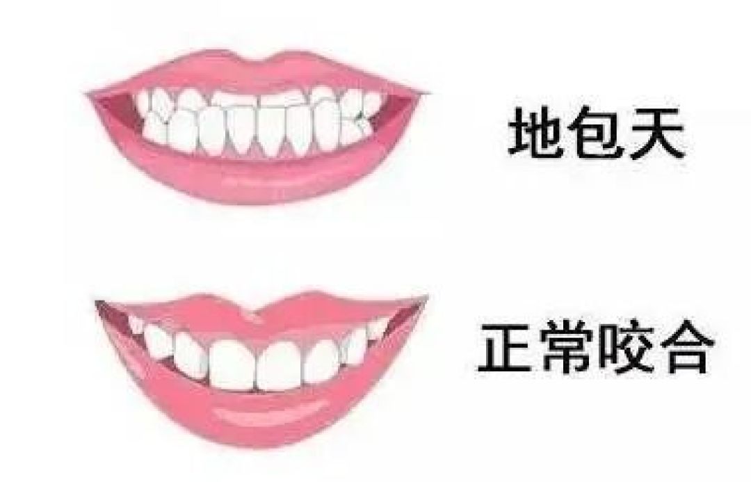 牙齿矫治要趁早!抓住寒假黄金期:别让“牙齿小事”影响孩子未来