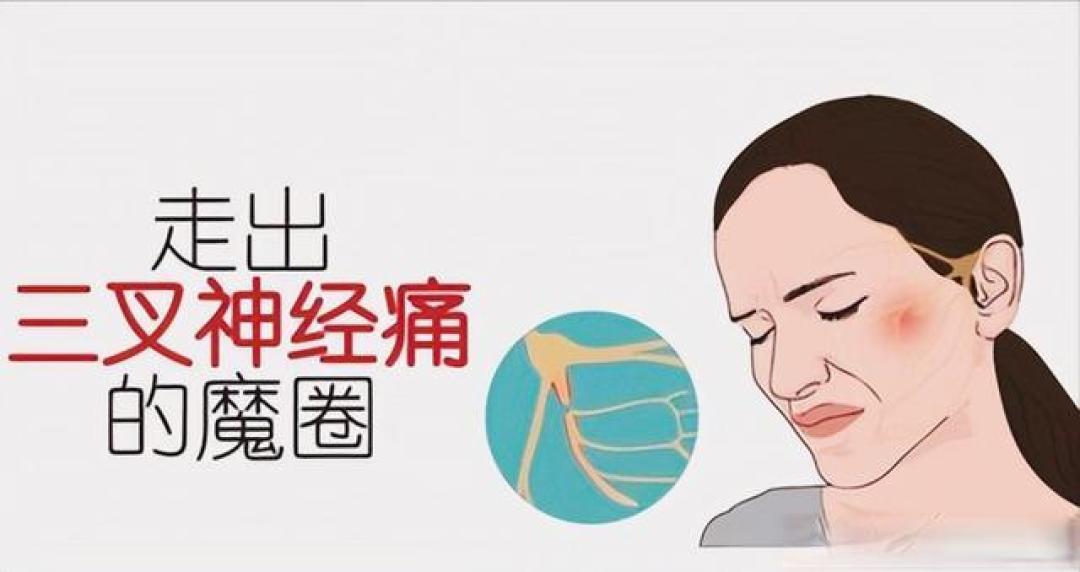 “天下第一痛”药物治疗无效？这份治疗路线图，为你指明方向