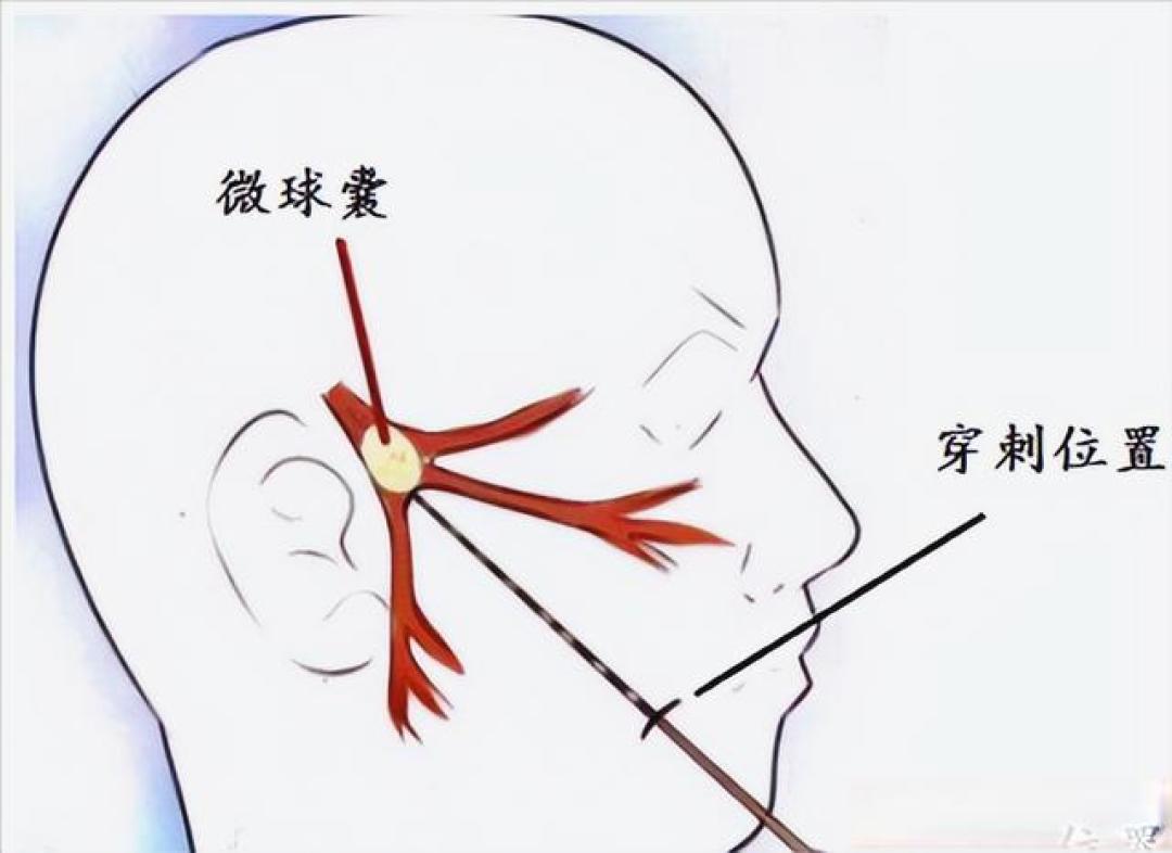 “天下第一痛”药物治疗无效？这份治疗路线图，为你指明方向
