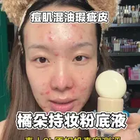 橘朵持妆粉底液  瑕疵皮无美颜无滤镜原相机自然光真实测评 #橘朵持妆粉底液 #底妆测评 #美妆测评 #粉底液真实测评 #美妆