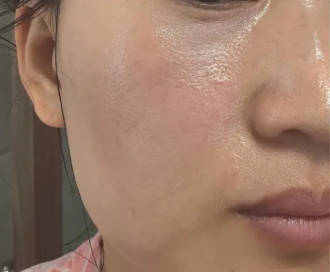 屏障受损修复,洗脸和面霜到底有多重要?