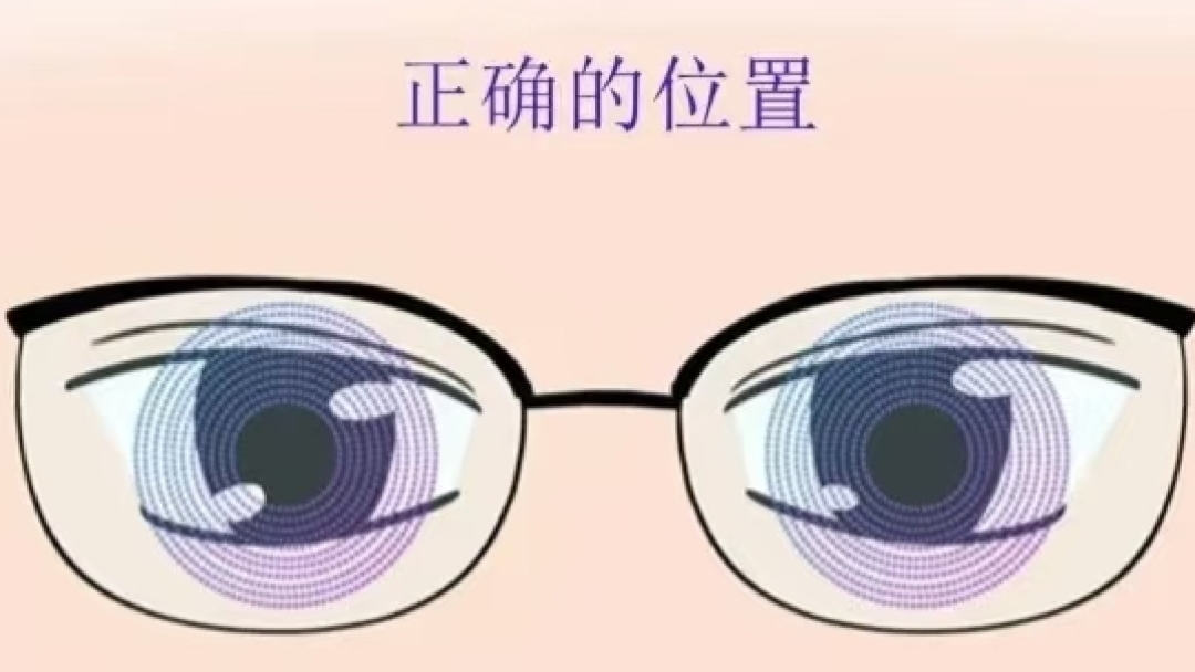 北京儿童离焦镜科普指南:守护孩子的清晰视界