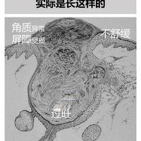 水杨酸/硫/壬二酸，The Ordinary油痘怎么用