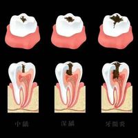 预防口腔疾病 守护牙齿健康