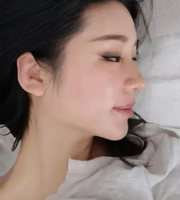 50+姐姐的敏感肌｜素颜也能透亮的护肤秘诀