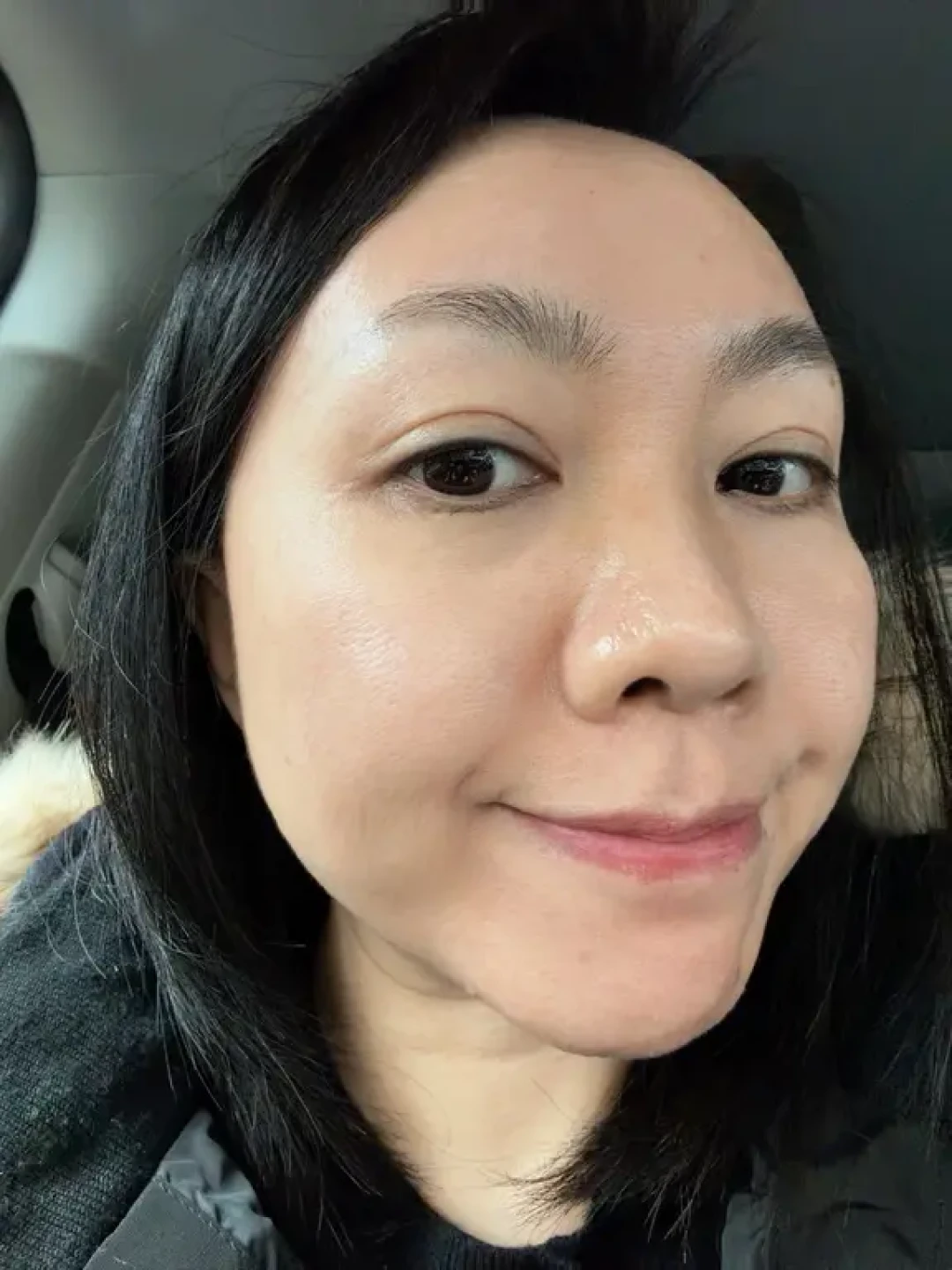 屏障受损,炎症排出来!我终于熬上岸了😹