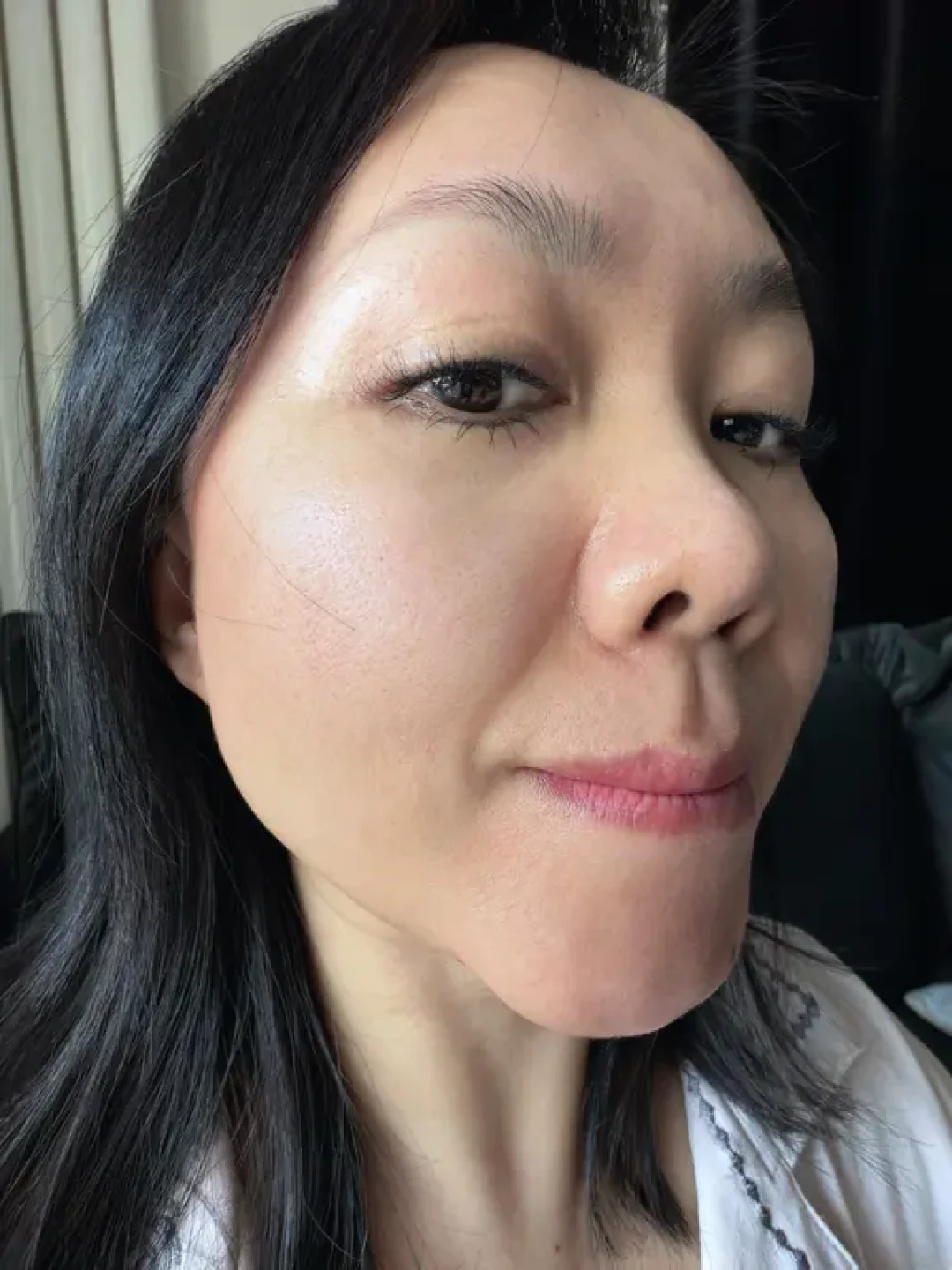 屏障受损,炎症排出来!我终于熬上岸了😹