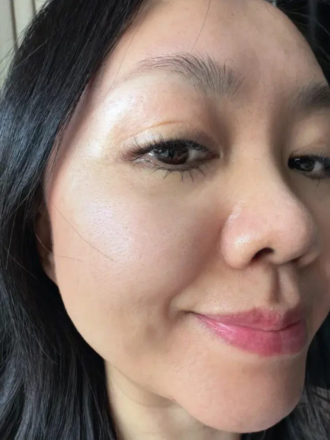 屏障受损,炎症排出来!我终于熬上岸了😹