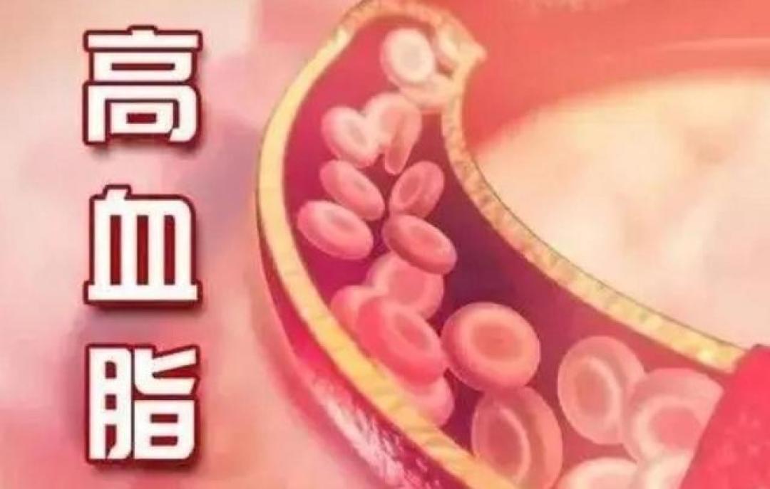 医生提醒:晚餐一改,高血脂症降三成!这3类晚餐常吃,养护血管