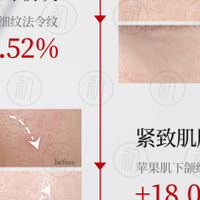 护肤品十大排名，淡纹抗皱好的护肤品，抗衰老提拉紧致产品推荐