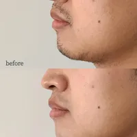 平价到高端：三款真正照顾痘肌的舒适剃须刀