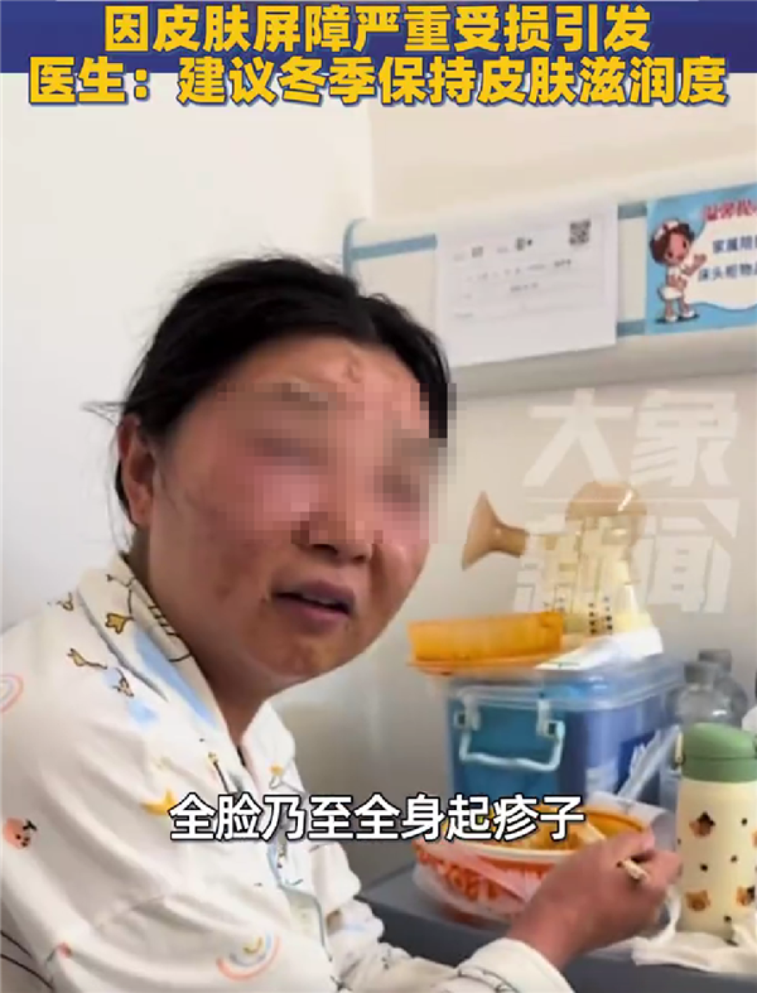 怕孩子被传染流感:新手宝妈频繁洗手致过敏、脸变形