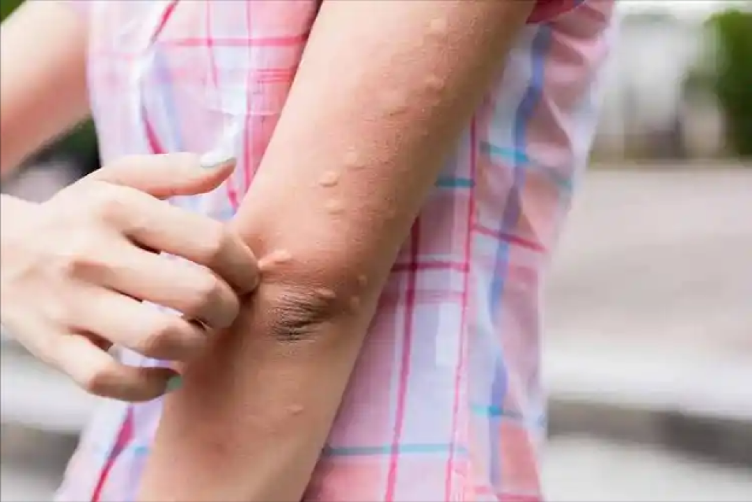 医生强调：糖尿病前期不是消瘦，而是经常出现这4个症状，别马虎