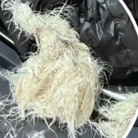 女子脸部被炸伤竟是这件过年必备衣服？羽绒服千万别再这样洗了！