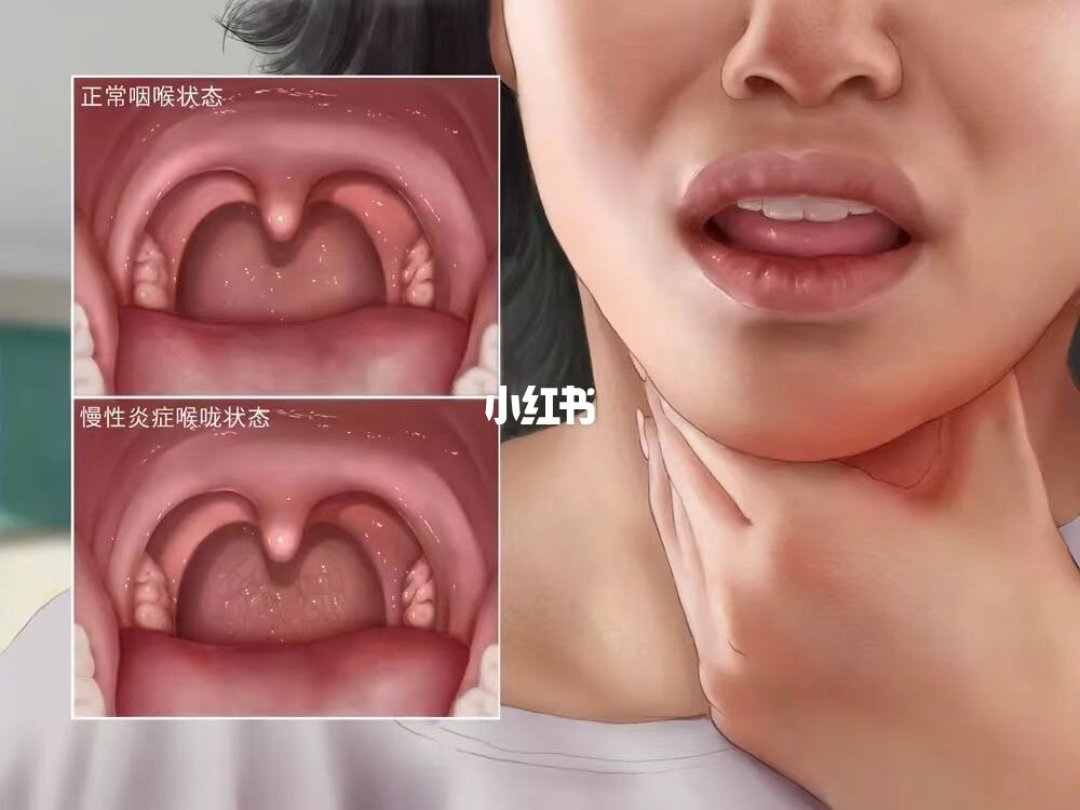 口臭熏人,主要从这两个方面解决
