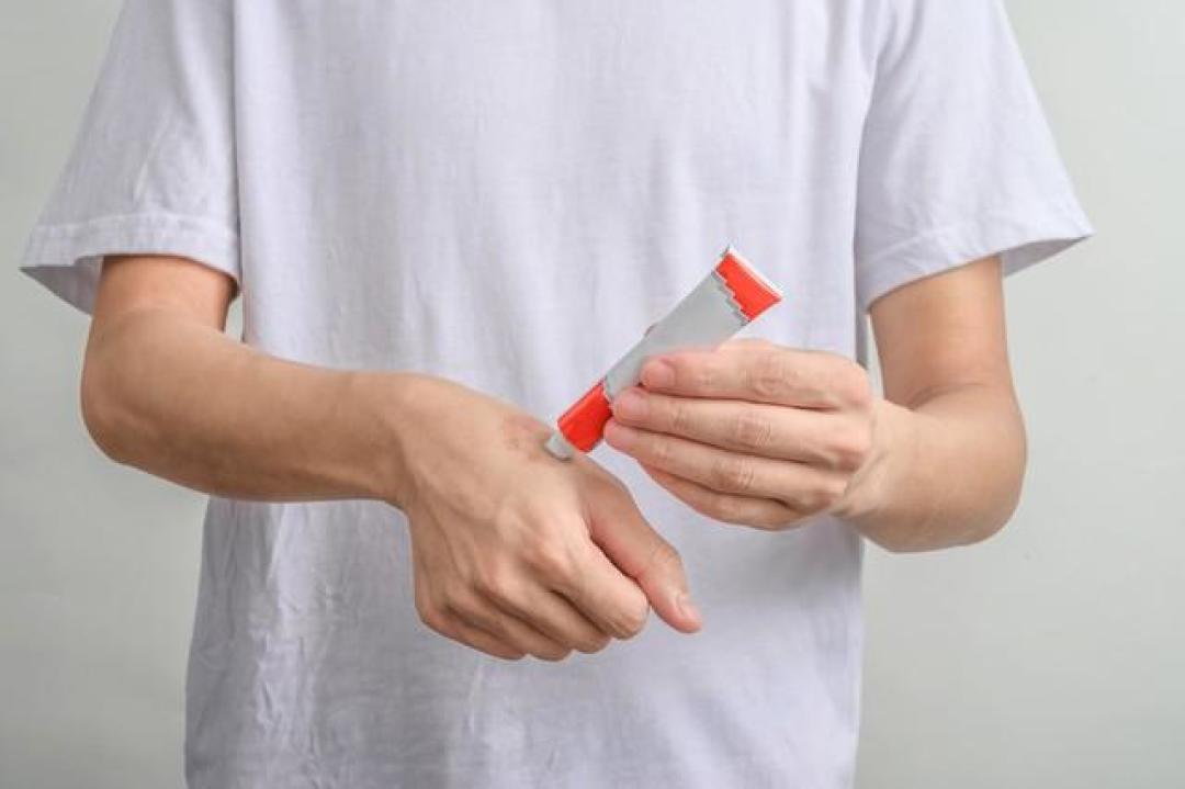 10款常用皮肤消炎药膏:对症选不踩坑,居家备用超省心