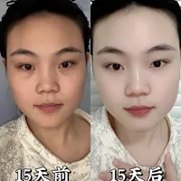 搞懂孕期护肤成分！不怕踩坑！别只盯大牌面膜