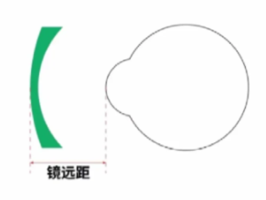 渐进镜总戴不舒服?春节前请收好这份攻略,轻松适应新眼镜