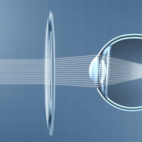 选离焦镜OR低对比度镜？看完这篇再决定！