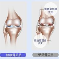 【氨糖】“关节守护神”，哪些人需要补？