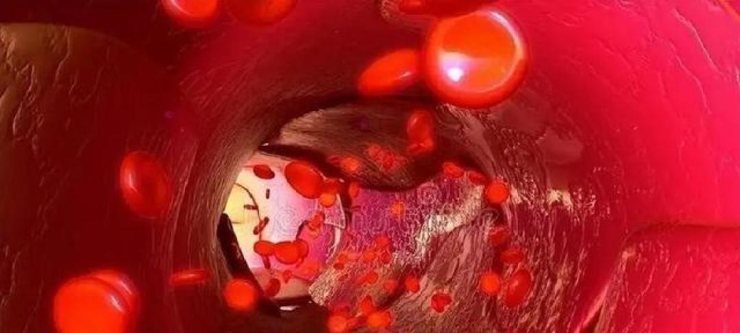 运动能降血糖？研究发现：这3种运动降血糖效果最佳