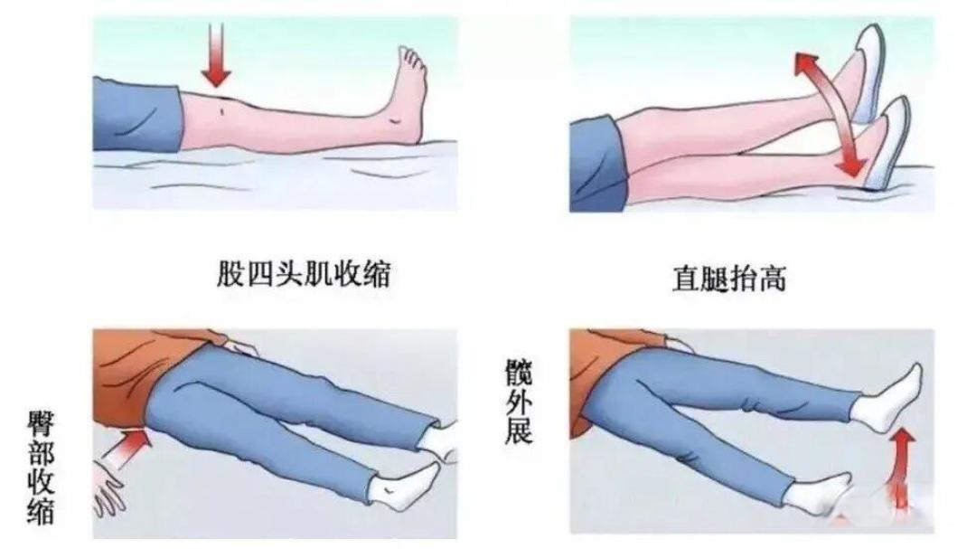 髋关节置换术后康复注意事项
