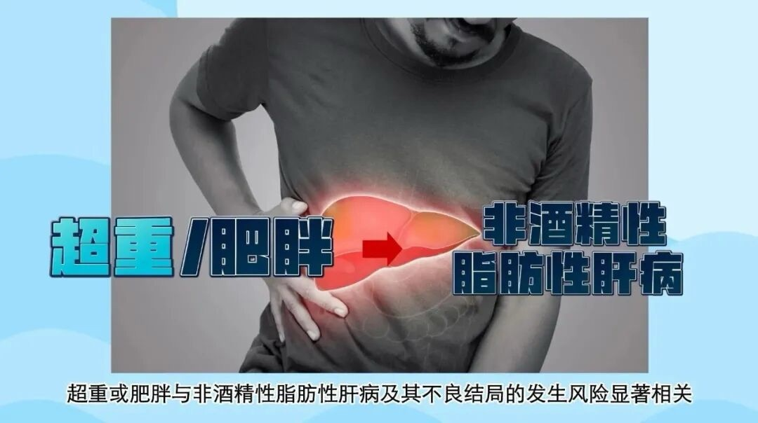 科学逆转脂肪肝:减重3%是起点,中西医结合是关键