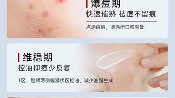 质润壬二酸精华霜全测评｜油痘肌黑头闭口的本命救星✨