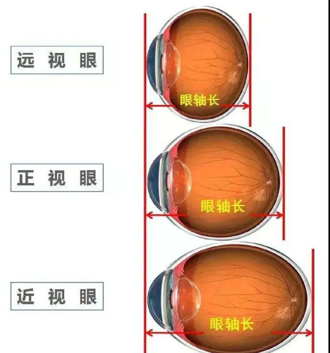 恢复视力之法。