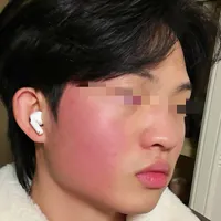 脂皮玫瑰 | 冬季稳定不爆发的顶级护肤思路