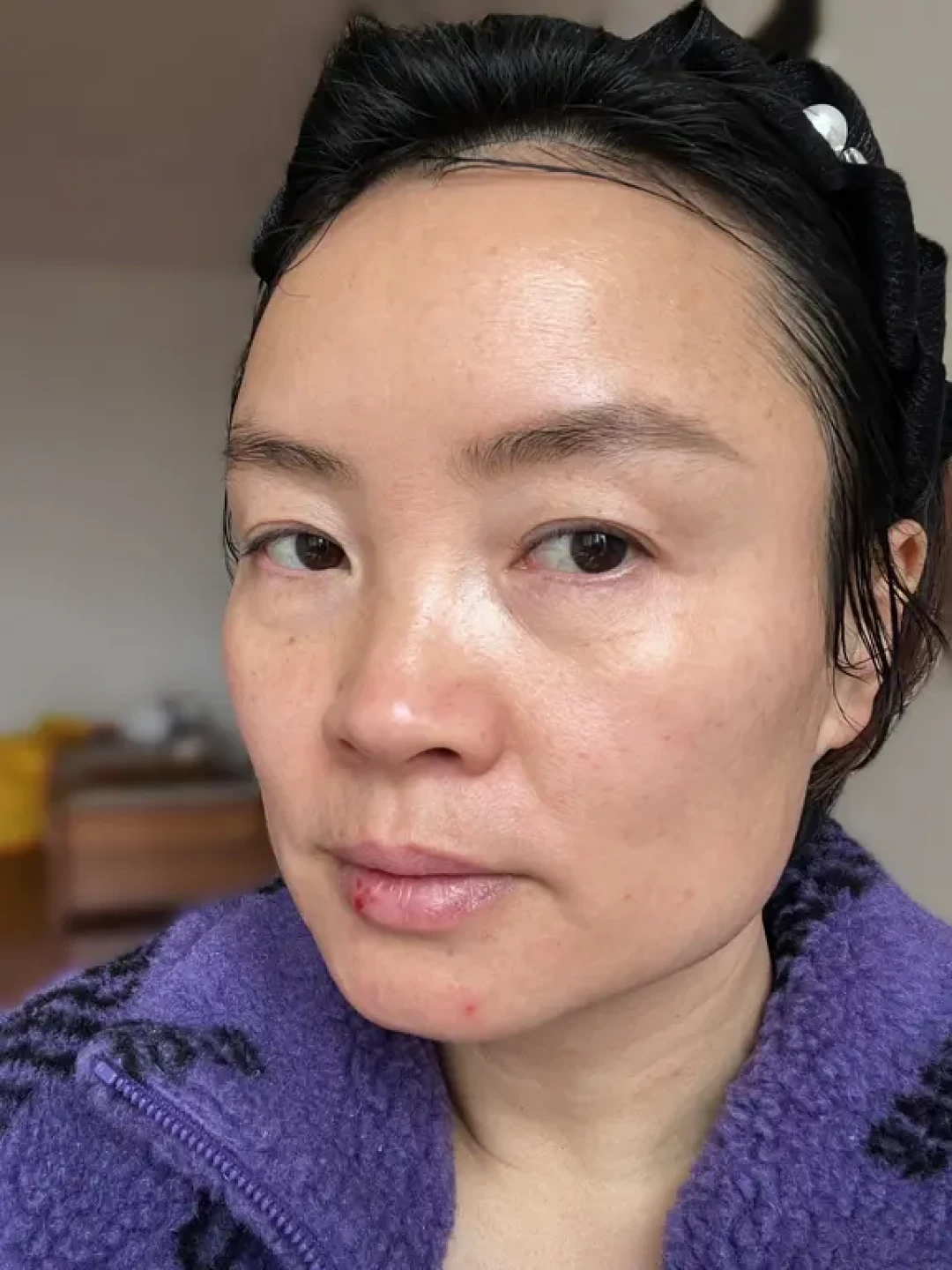 角质层薄 干敏斑皱 秋冬上岸（详细版）