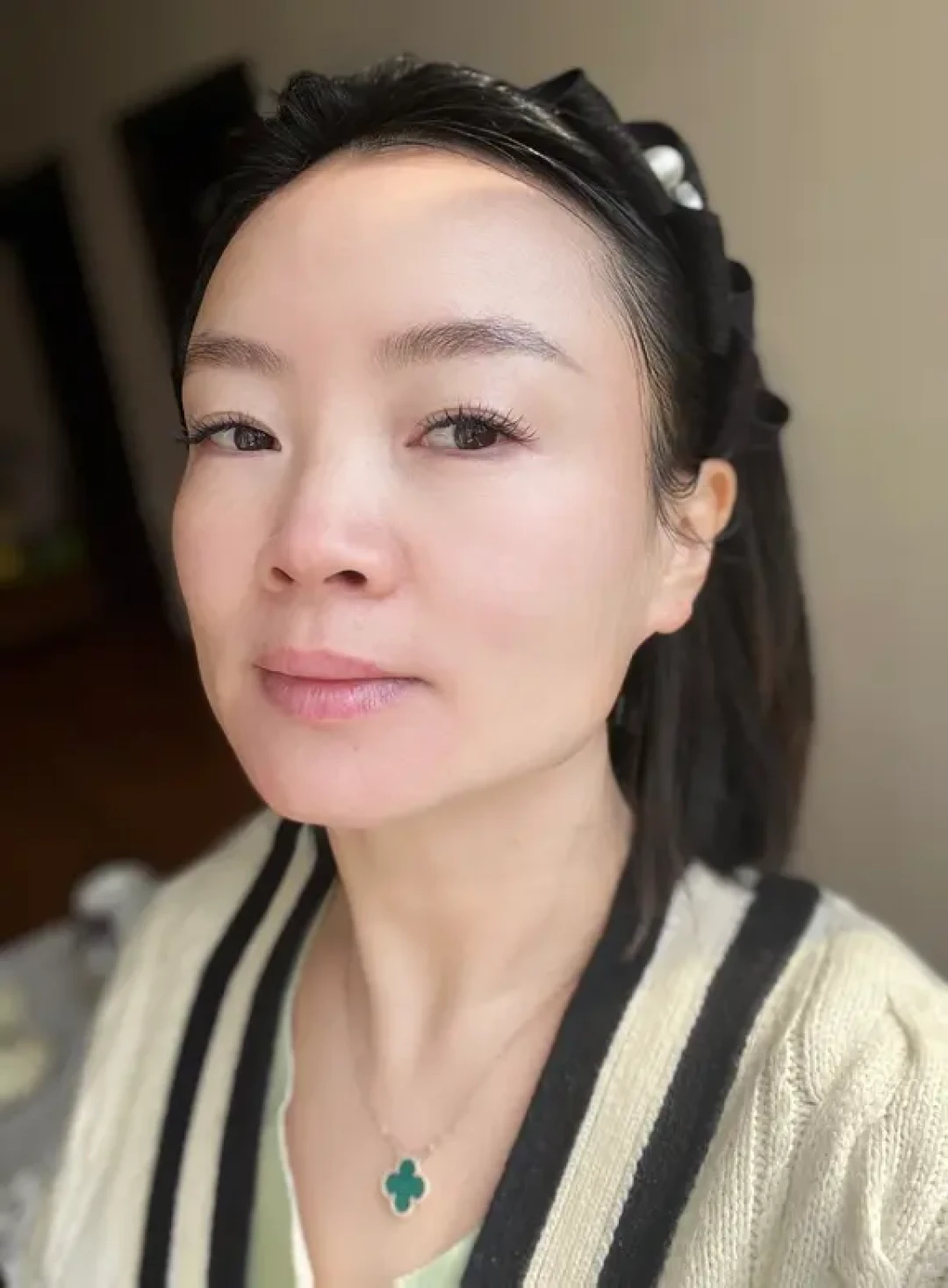 角质层薄 干敏斑皱 秋冬上岸（详细版）