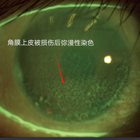 一种巨伤眼的行为，很多女生最近都在做！（不是戴美瞳）