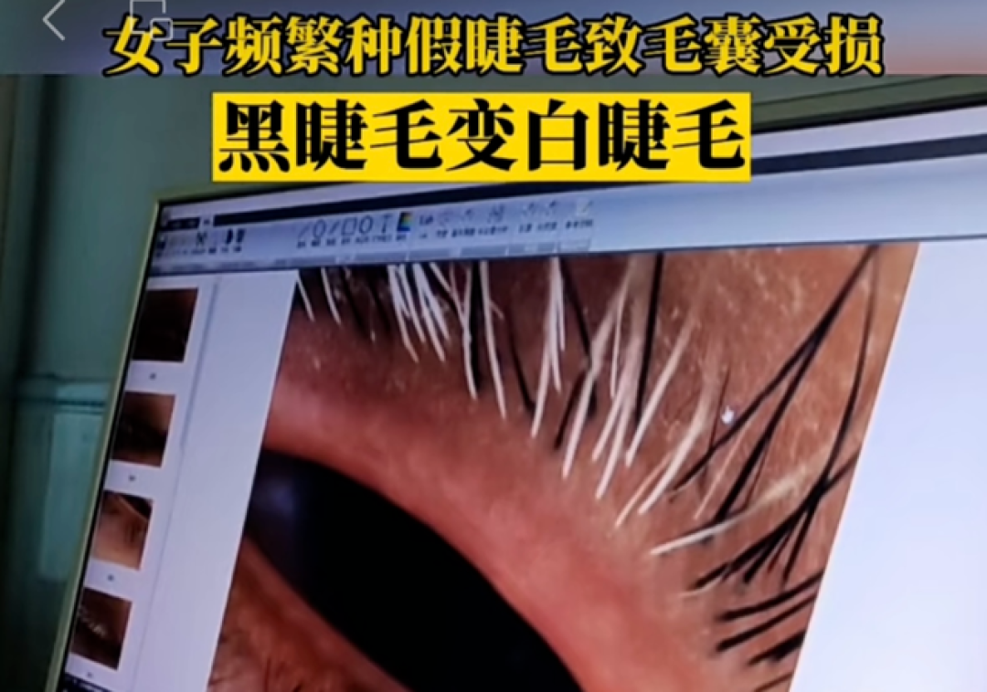 一种巨伤眼的行为,很多女生最近都在做!(不是戴美瞳)