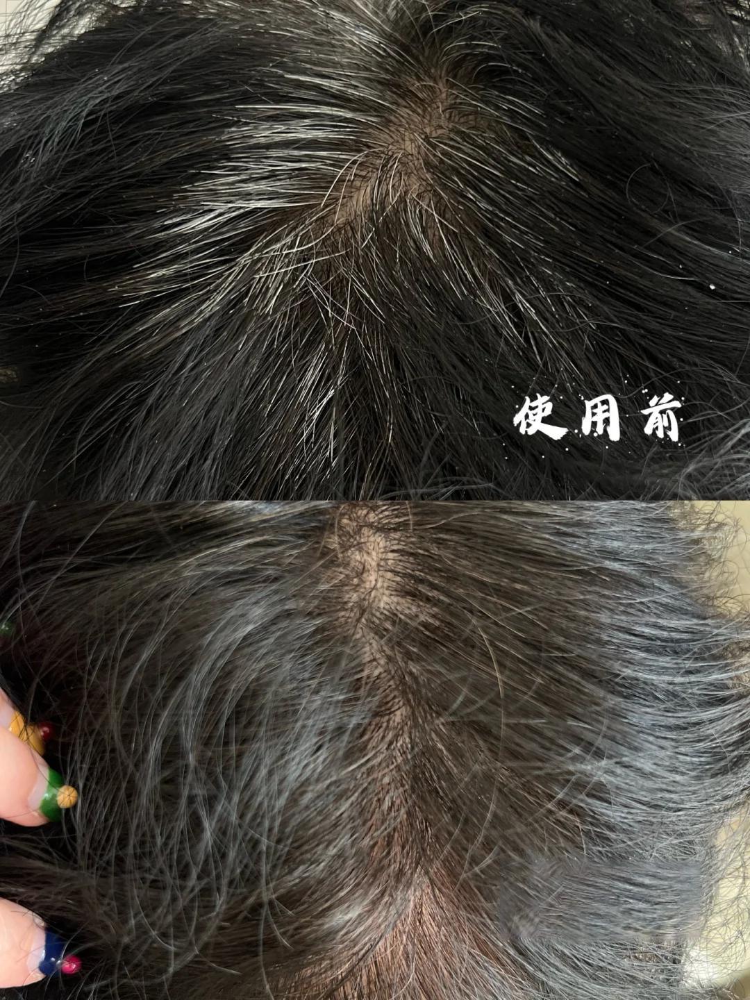 𝓹𝓵𝓸𝓰 🩵给妈妈染发翻车?这次我选对了!
