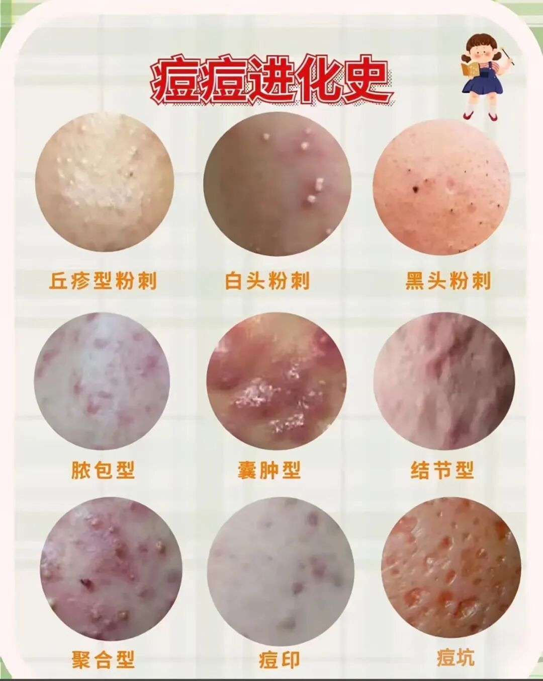 战 “痘” 全攻略|从成因到解决,科学护肤不踩坑